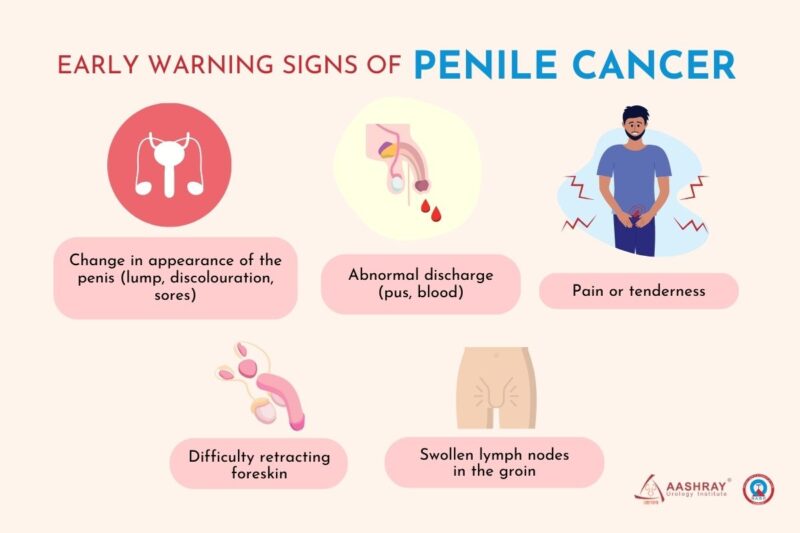 Symptoms of Penile Cancer