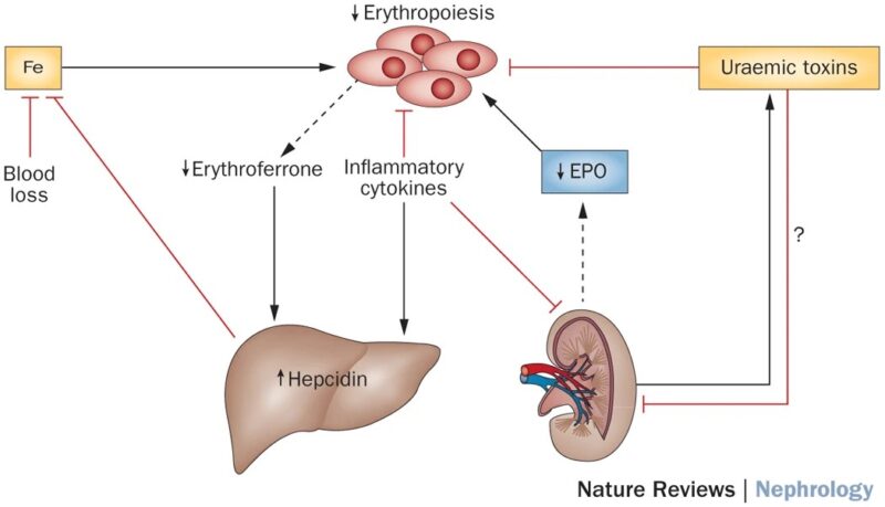 Nihar Desai: Anemia in CKD