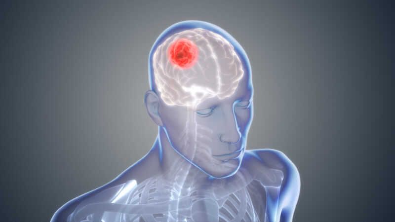 glioblastoma awareness day
