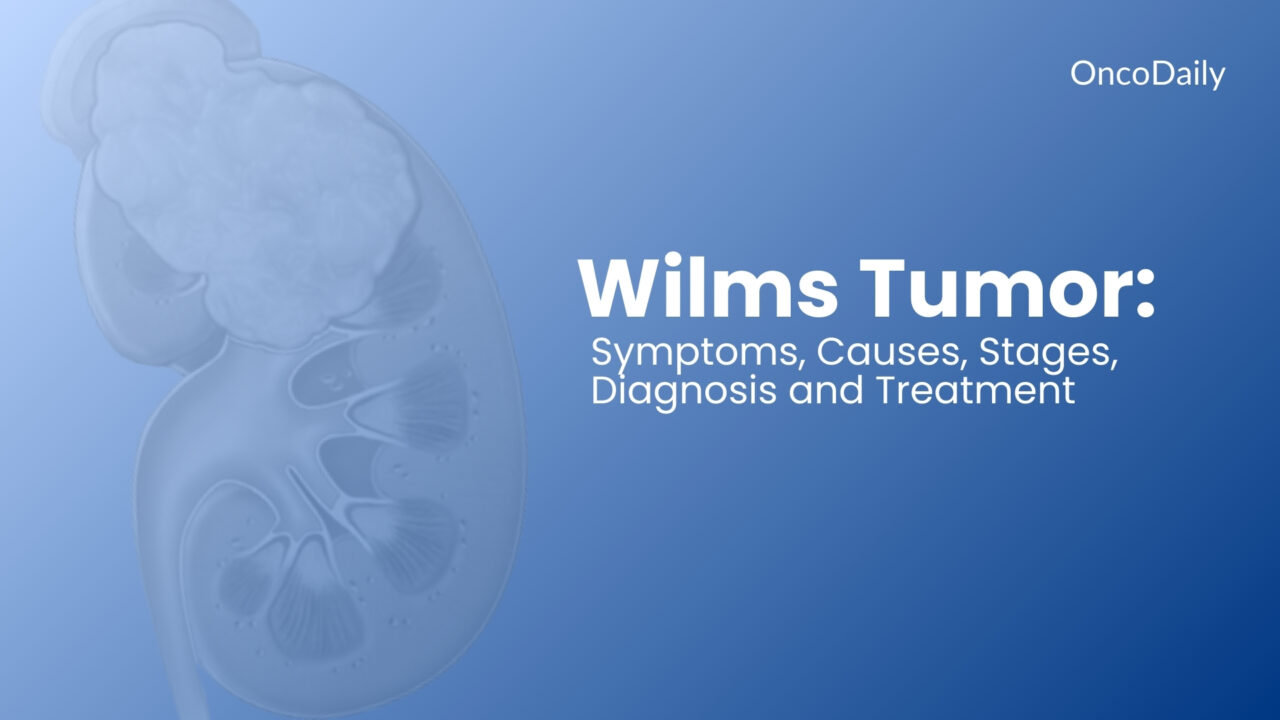 Wilms Tumor: Symptoms, Causes, Stages, Diagnosis and Treatment