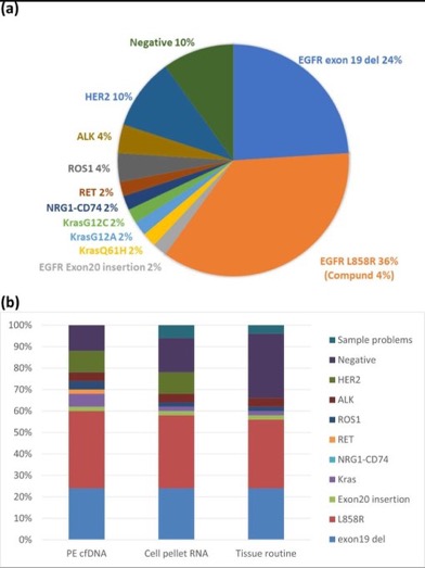 Yakup Ergün: NSCLC Mutation Detection via Pleural Effusion cfDNA Sequencing