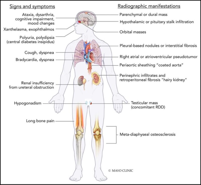 Learning hematology in 2025 with Nico Gagelmann: Part 2