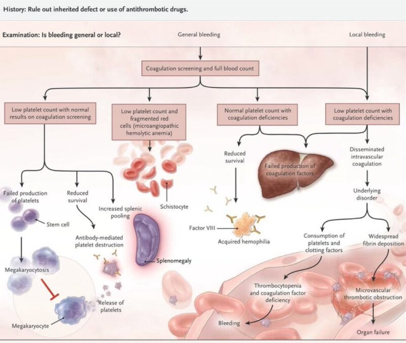 Learning hematology in 2025 with Nico Gagelmann: Part 2