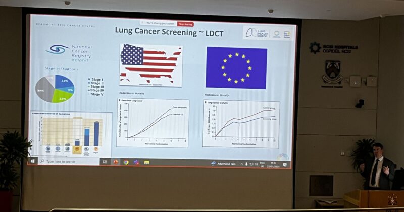 Jarushka Naidoo: Early detection of lung cancer showcased at Beaumont Hospital by Daniel J Ryan