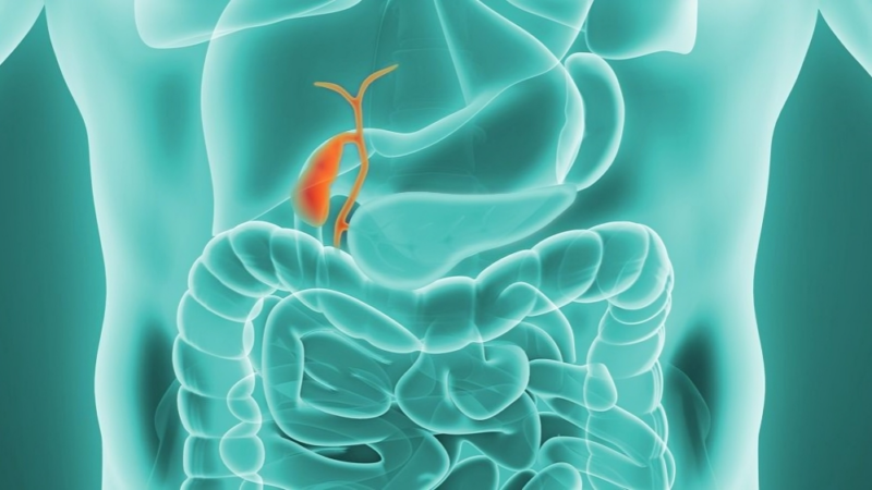 Senthil Kumar: First-Line Treatment Strategies for Advanced/Metastatic Gallbladder Cancer