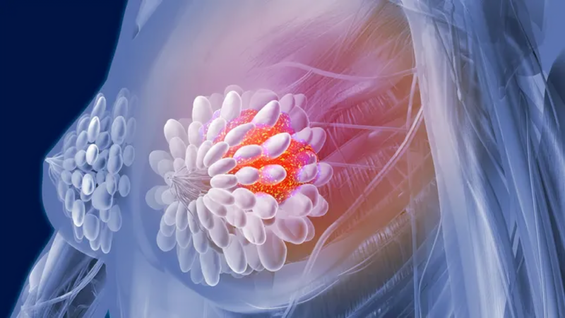 CAR-T cell therapy