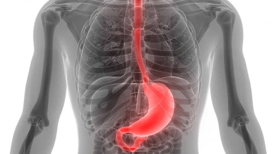 Amol Akhade: Oligometastatic Esophageal Gastric cancers