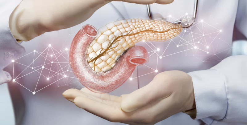 KRAS Mutation Status and Treatment Outcomes in Patients with Metastatic Pancreatic Adenocarcinoma