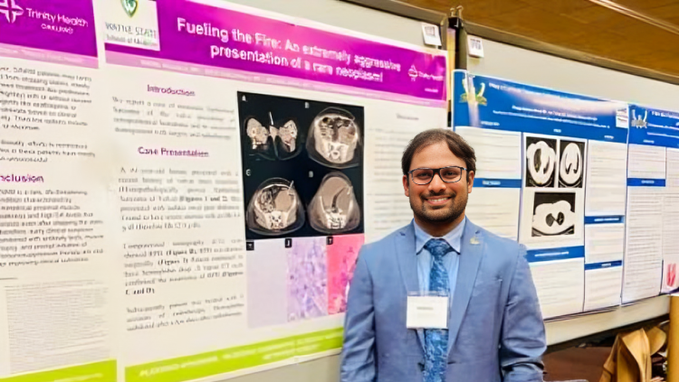 Bosutinib-Induced Pleural Effusion—Class Effect and Cross-Intolerance to All Tyrosine Kinase Inhibitors by Nikhil Vojjala et al.