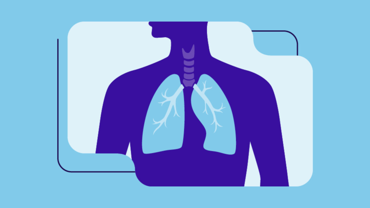 The importance of lung cancer research cannot be understated – Global Lung Cancer Coalition