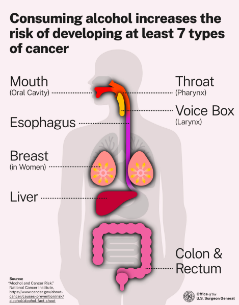 Alcohol and Cancer Risk: The U.S. Surgeon General’s Advisory 2025