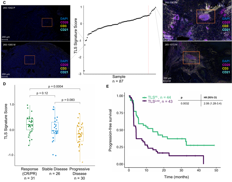 Lena Wirth: TLS and T-Cell Exhaustion Drive PD-1 Blockade Responce in RCC