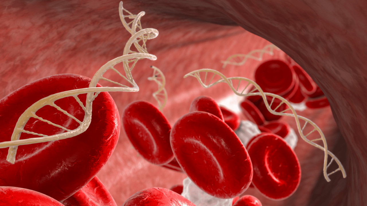 Matthew Oberley: Characterization of plasma cfDNA variants as of tumor- or clonal hematopoiesis-origin