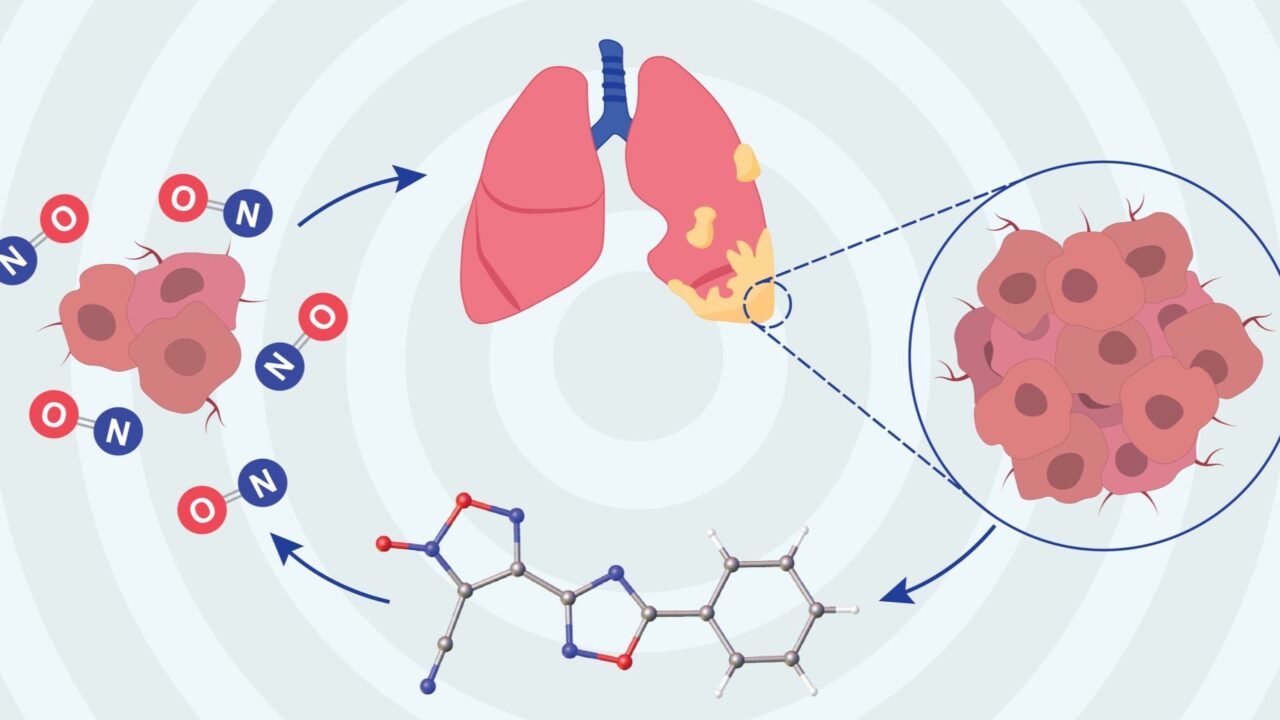 Anticancer potential of NO-Donor Oxadiazole in malignant pleural mesothelioma – The Babak Lab