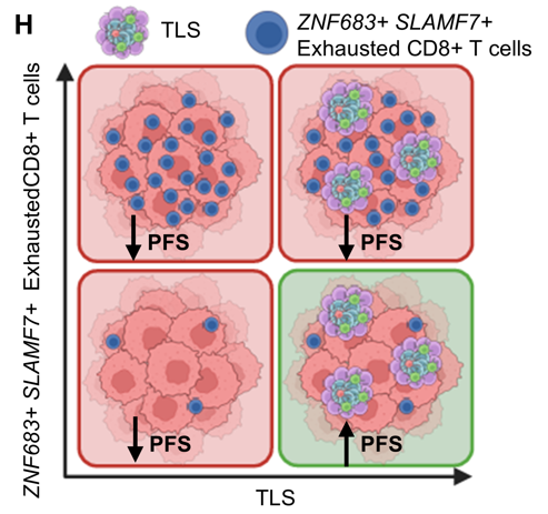 Lena Wirth: TLS and T-Cell Exhaustion Drive PD-1 Blockade Responce in RCC