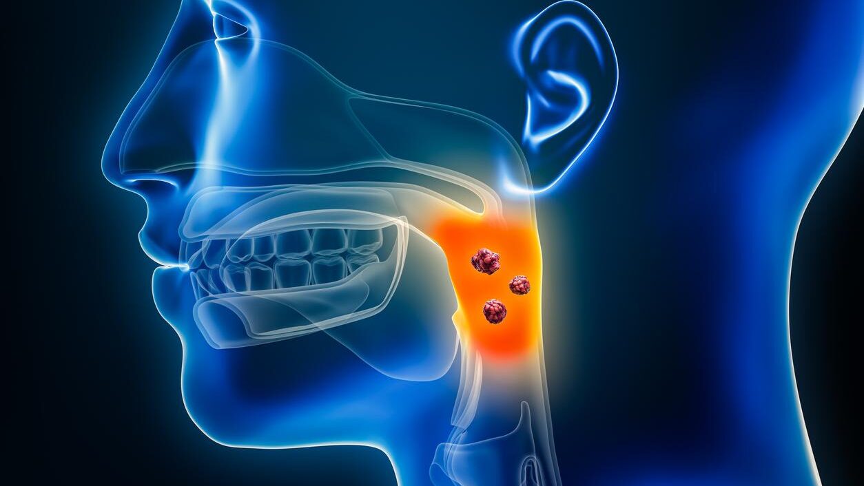 Samuel Chao: Protons versus photons for oropharyngeal cancer