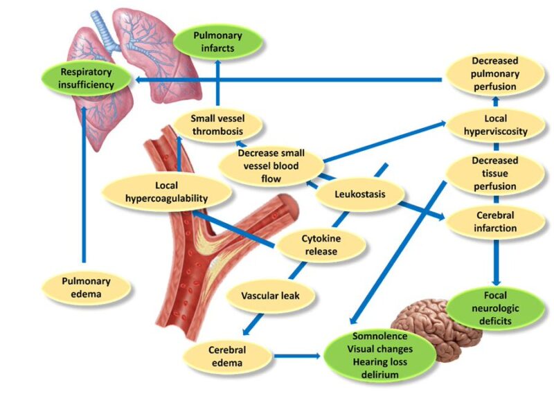 Learning hematology in 2025 with Nico Gagelmann: Part 3