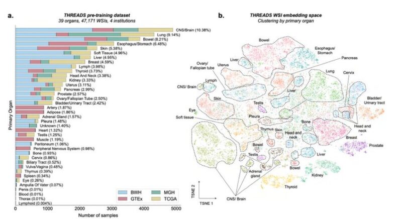 Simona Cristea: Impressive advancement in Computational Pathology