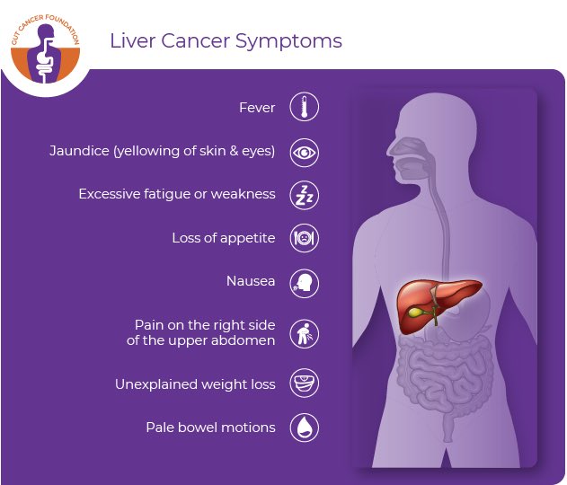 Shahrin Ahmed: Liver cancer risk rises after successful DAA therapy for HCV