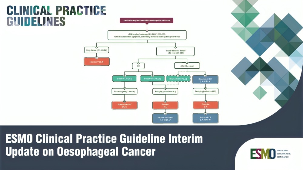 ESMO Clinical Practice Guideline eUpdate on Oesophageal Cancer