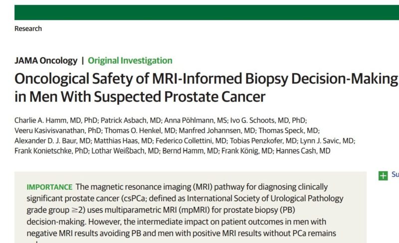 Yüksel Ürün: Can biopsy be omitted after a negative MRI in suspected prostate cancer?