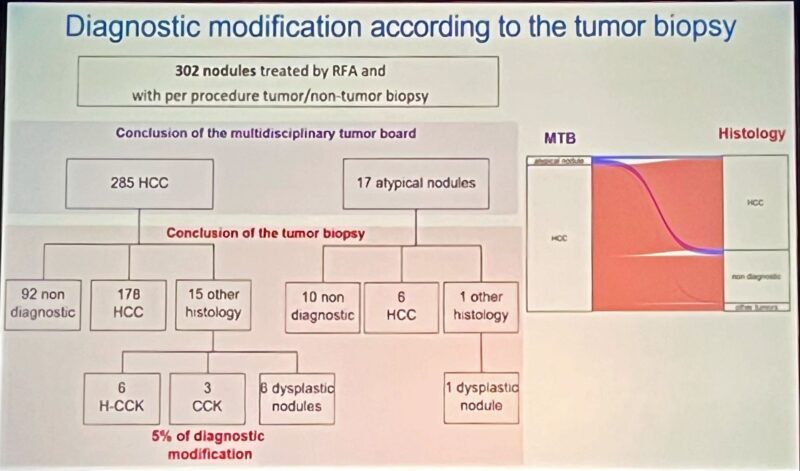 Angela Lamarca: Liver biopsy in suspected HCC data presented at Liver Cancer Summit 2025