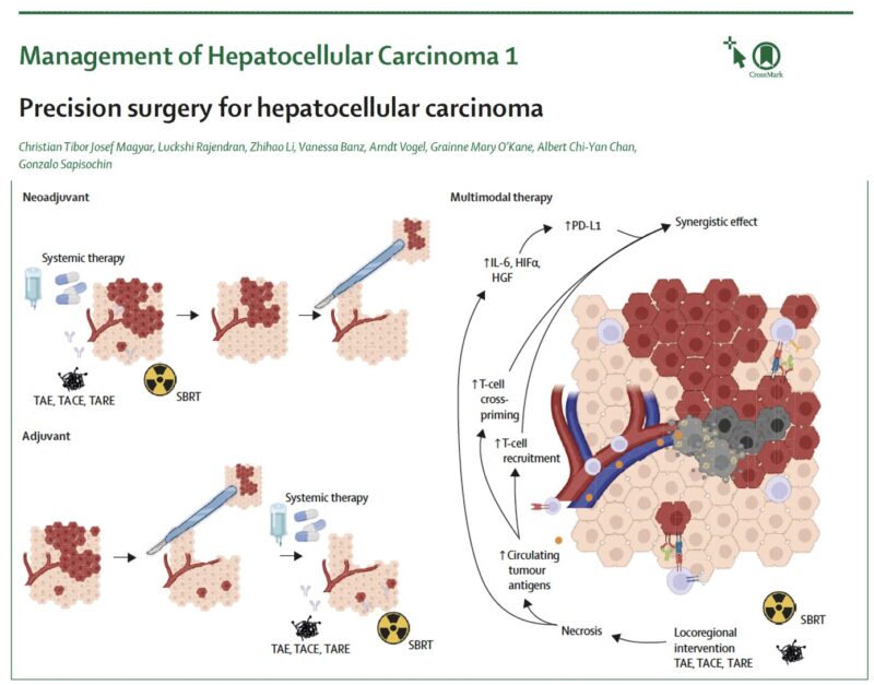 Arndt Vogel: Precision surgery for hepatocellular carcinoma