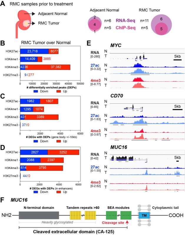 Pavlos Msaouel: Serum CA-125 as a biomarker for Renal Medullary Carcinoma