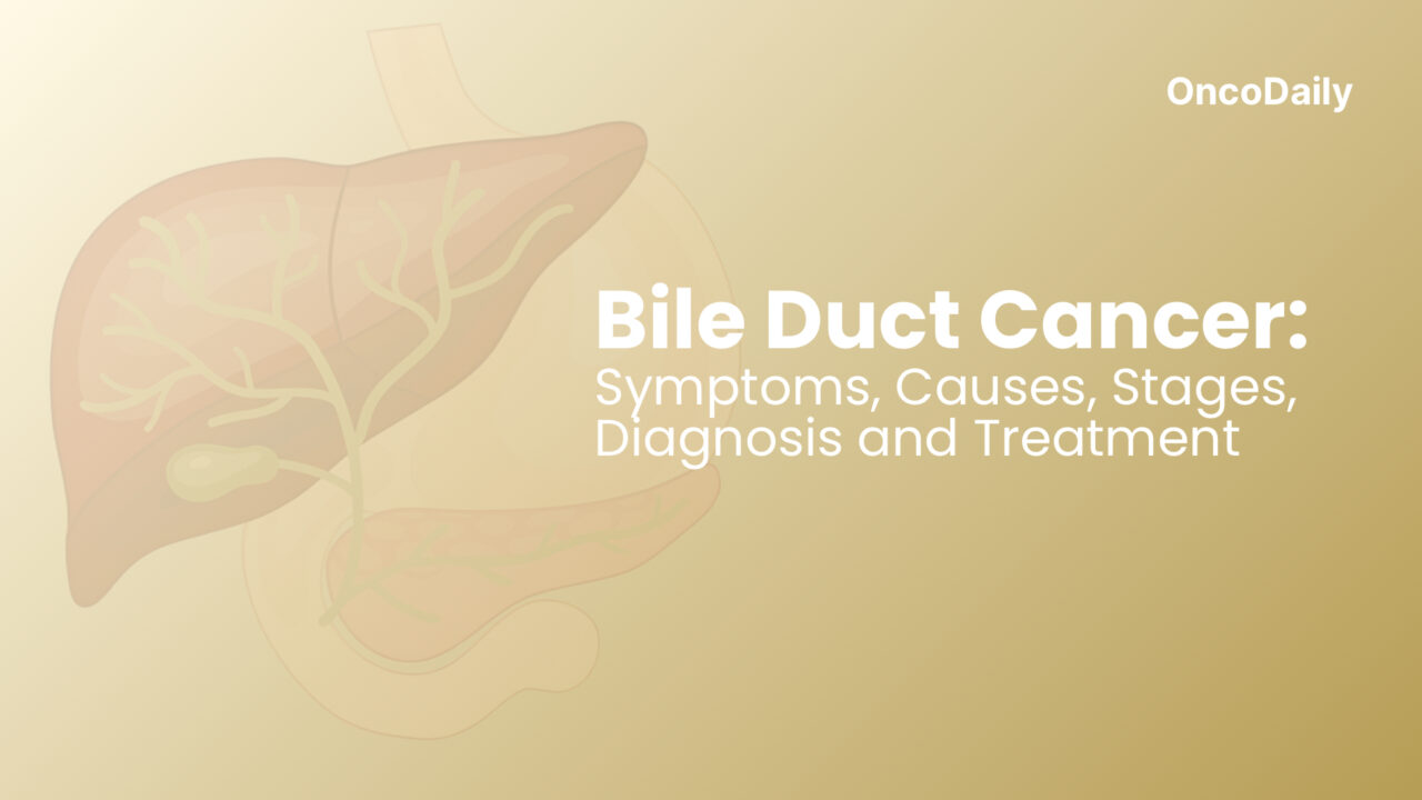 Bile Duct Cancer: Symptoms ,Causes, Stages, Diagnosis and Treatment