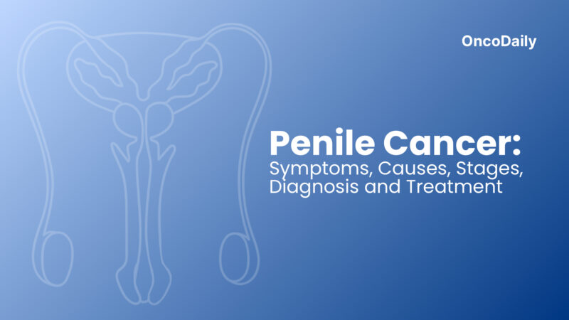 Penile Cancer: Symptoms and Causes, Stages, Diagnosis and Treatment