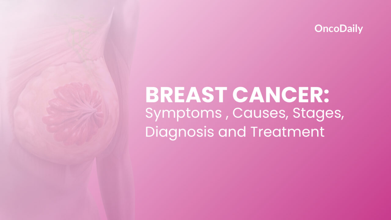 Breast Cancer: Symptoms Causes, Stages, Diagnosis and Treatment