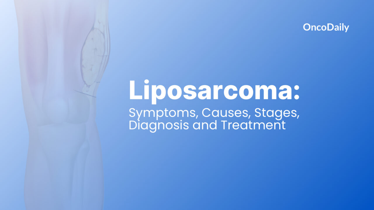 Liposarcoma: Symptoms, Causes, Stages, Diagnosis and Treatment