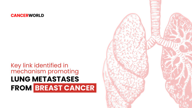 Key link identified in mechanism promoting lung metastases from breast cancer