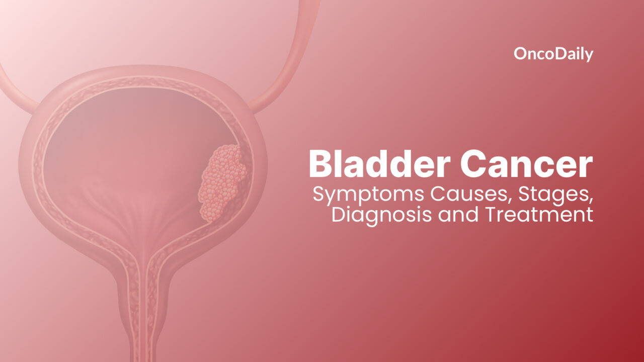 Bladder Cancer: Symptoms ,Causes, Stages, Diagnosis and Treatment