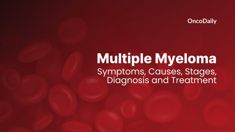 Multiple Myeloma: Symptoms, Causes, Stages, Diagnosis and Treatment