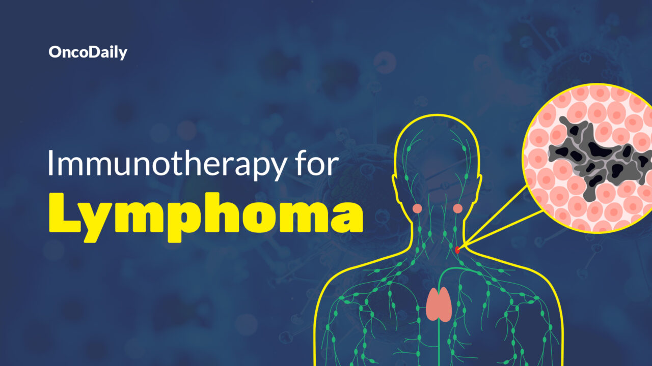 Immunotherapy for Lymphoma: Types, Success Rate, Side Effects and More