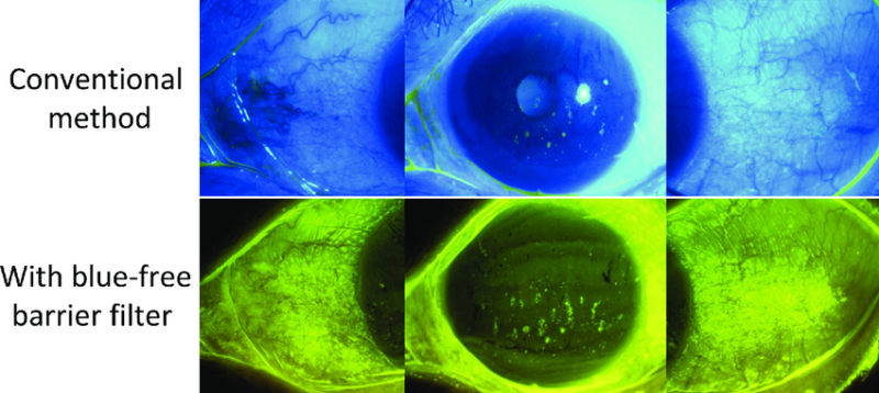 The use of a yellow filter allows assessment of conjunctival staining with fluorescein antibody drug conjugates ocular effects