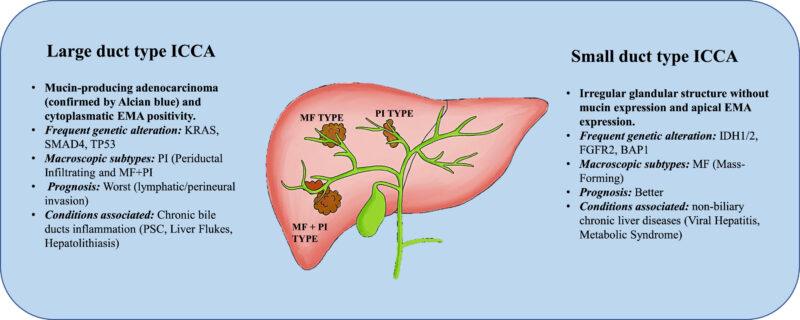 two subtypes of ICC