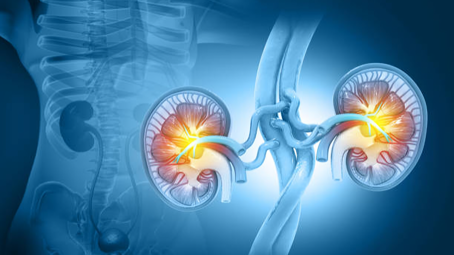 ctDNA: A game-changer in kidney cancer? 