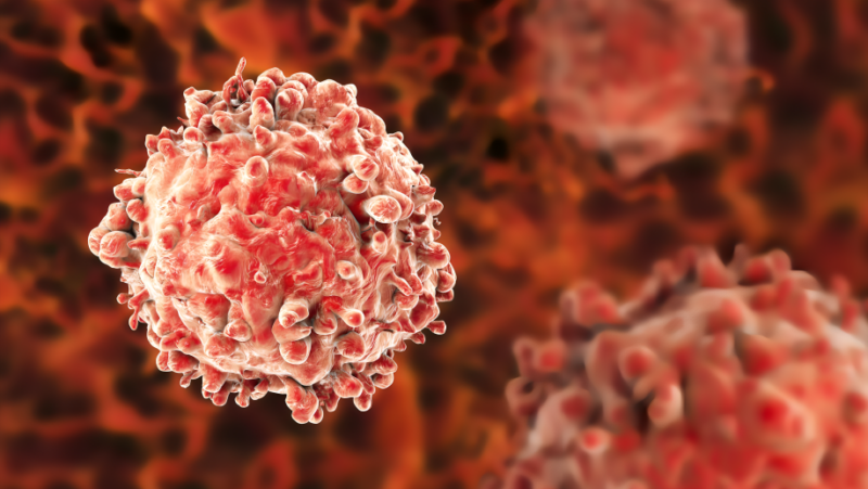 Hematopoietic Stem Cell Transplantation Outcomes for High-Risk Acute Myeloid Leukemia