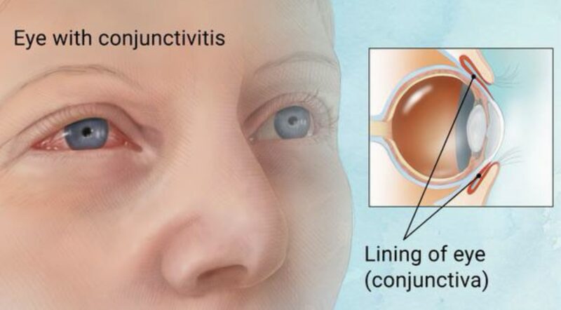 eye toxicity