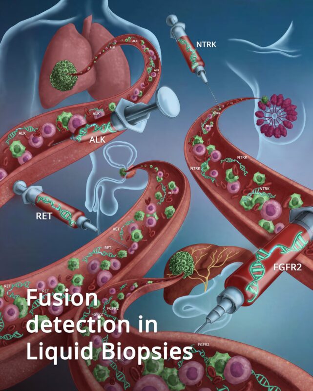 Pashtoon Kasi: Is it a myth that fusions cannot be detected on Liquid Biopsies?