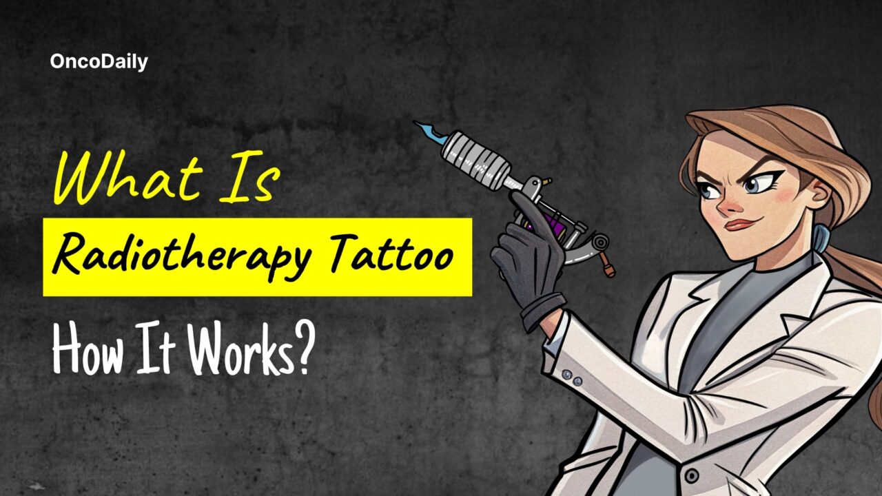 What Is Radiotherapy Tattoo and How It Works?