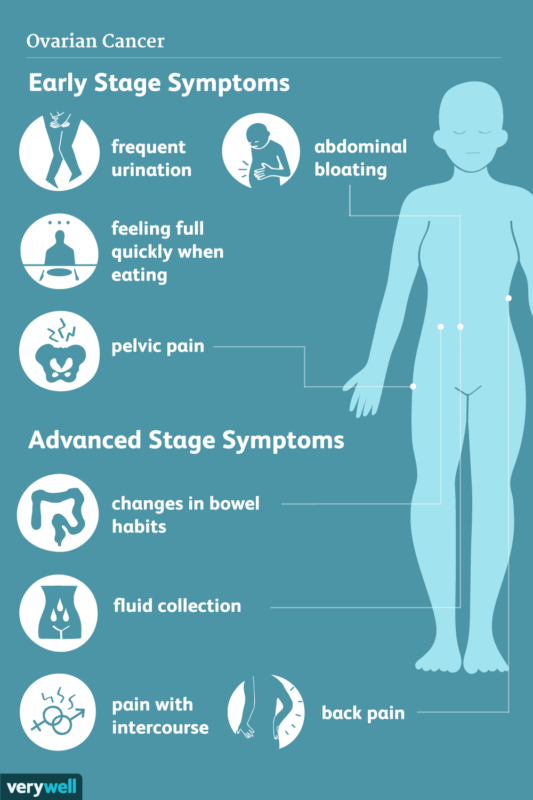 Symptoms of Ovarian Cancer