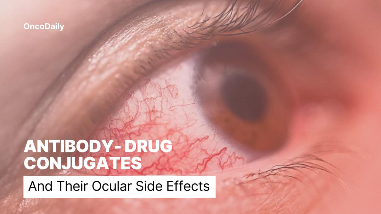 Antibody-Drug Conjugates and Their Ocular Effects in Cancer Treatment: Efficacy and Toxicity