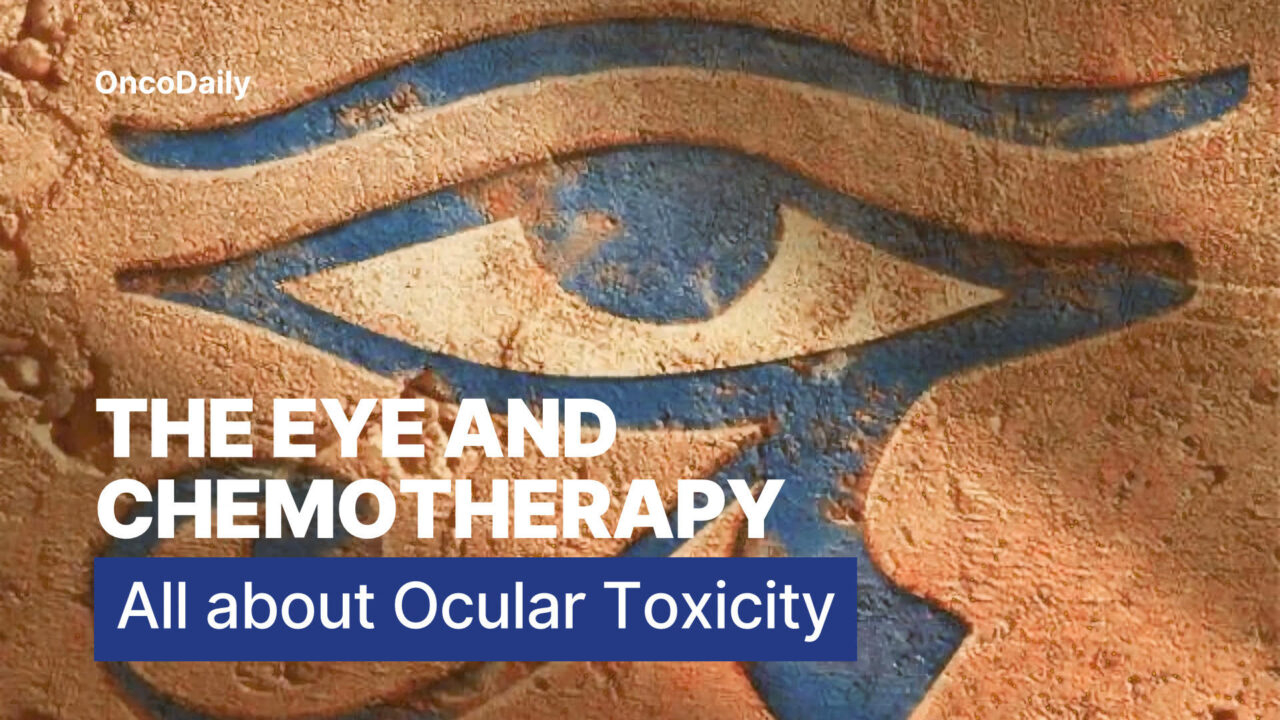 Ocular Side Effects of Chemotherapy: Understanding the Risks of Eye Toxicity