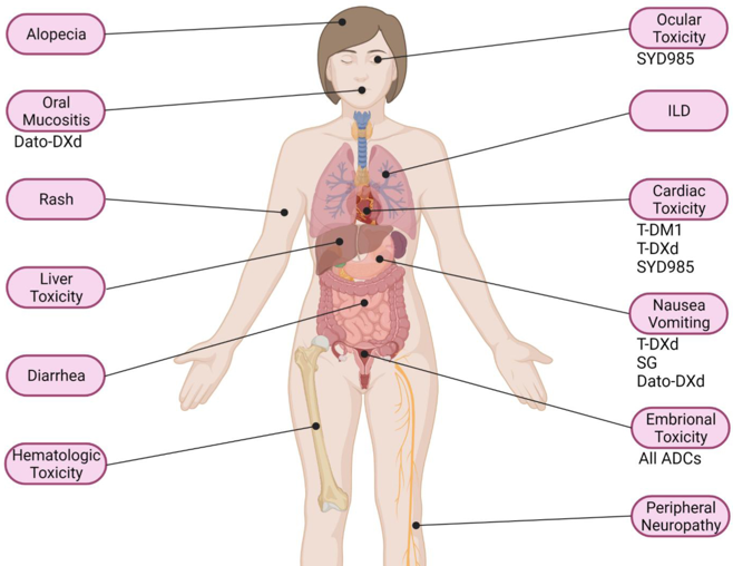 Antibody Drug Conjugates side effects