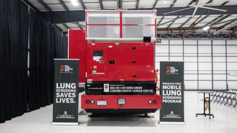 Indiana’s first mobile lung screening program is officially on the road – IU Simon Comprehensive Cancer Center