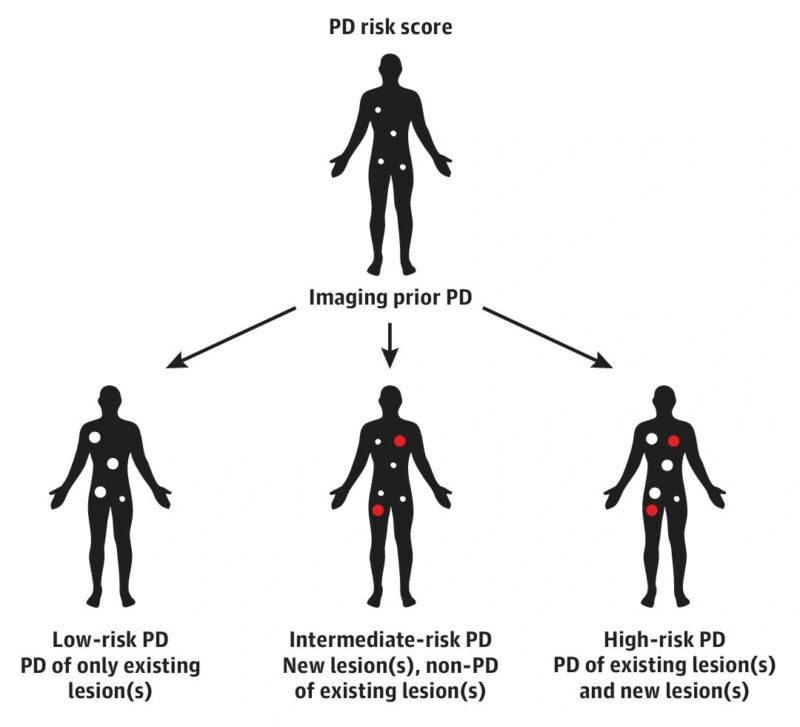 Loay Kassem: Not all patients who fail on immunotherapy have poor prognosis