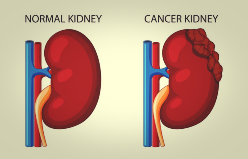 Medicaid Cancer Foundation